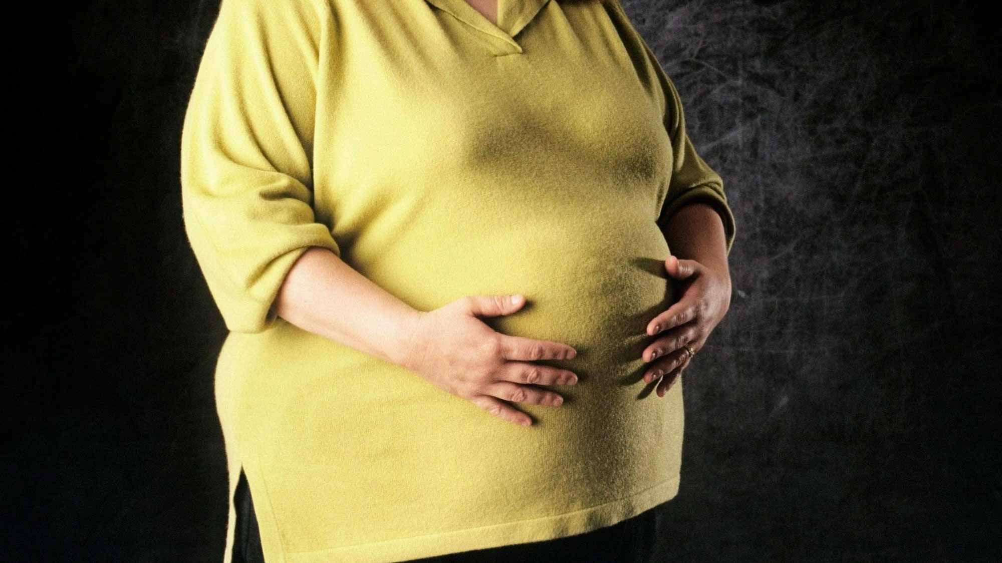 Врачи находят связь между лишним весом и скрытой беременностью