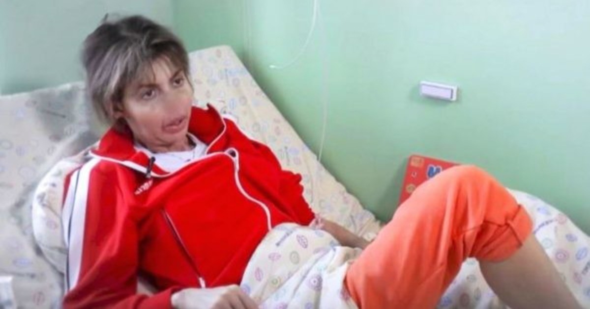 Когда Алиса Аршавина сможет восстановить изуродованное лицо?  Анализ хирурга