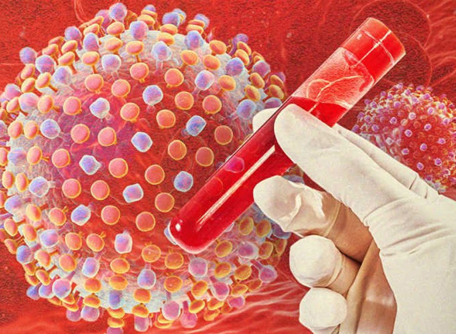Вирусный гепатит: симптомы, пути заражения