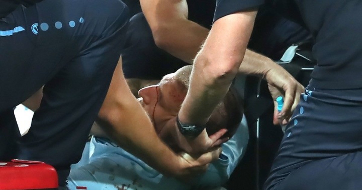 Футболист Миладинович потерял сознание и залился кровью с поля во время матча — видео