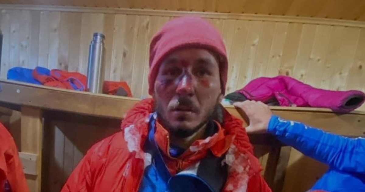 Жуткие фото выживших на Эльбрусе альпинистов