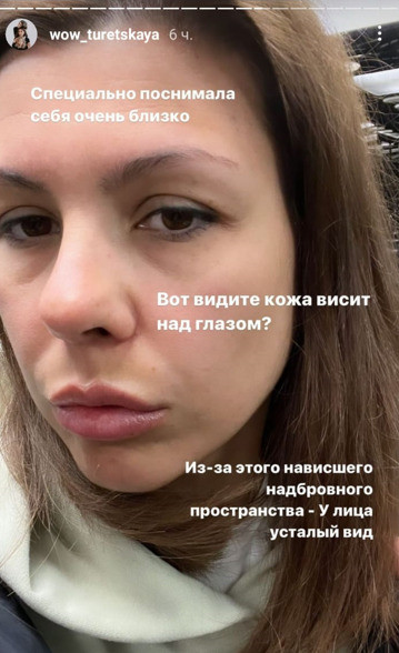 Наталья недовольна собственной внешностью Наталья недовольна собственной внешностью