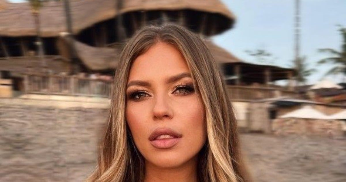Рита Дакота сделала пластику носа