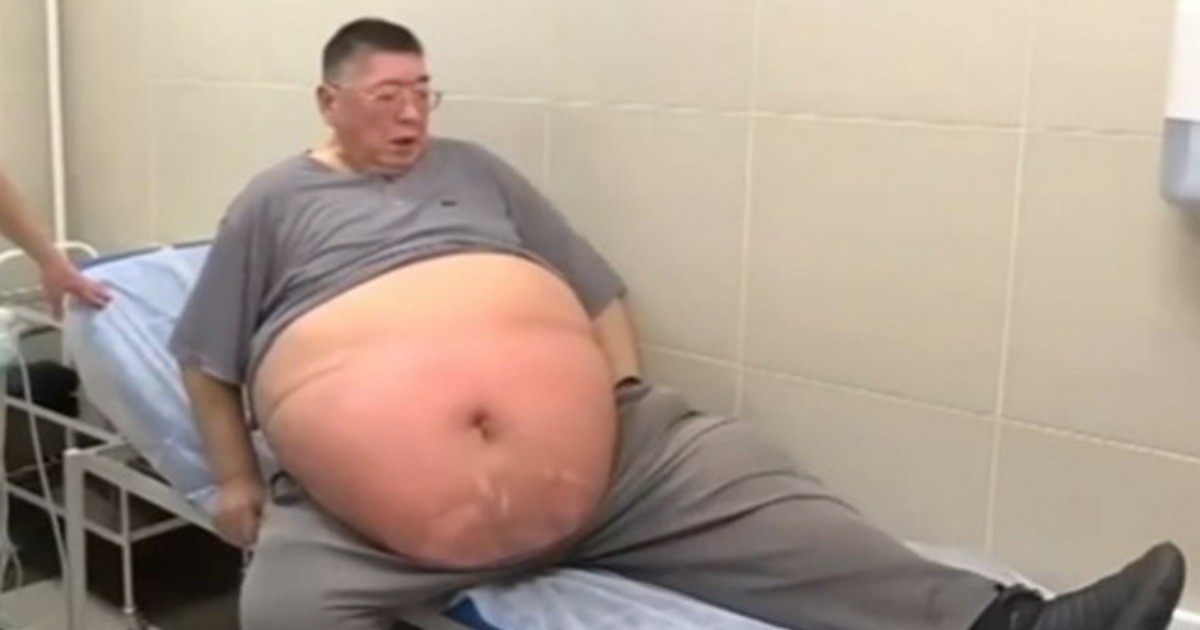 «Умри скорее и не мучайся»: мужчина набрал вес до 220 килограммов и ему не делают операцию