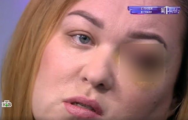Татьяна боится, что может совсем потерять глаз.