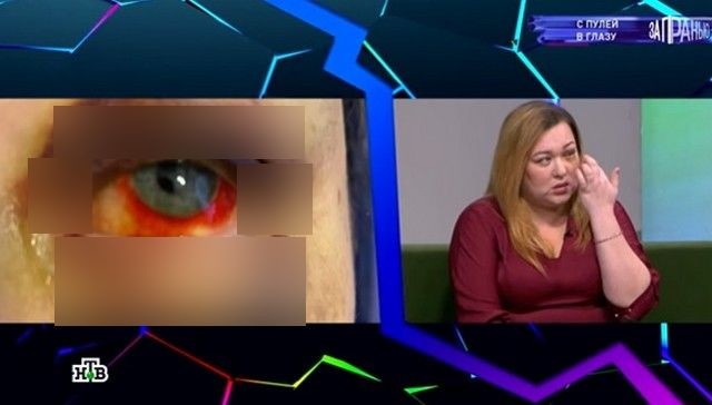 Отек спал больше месяца