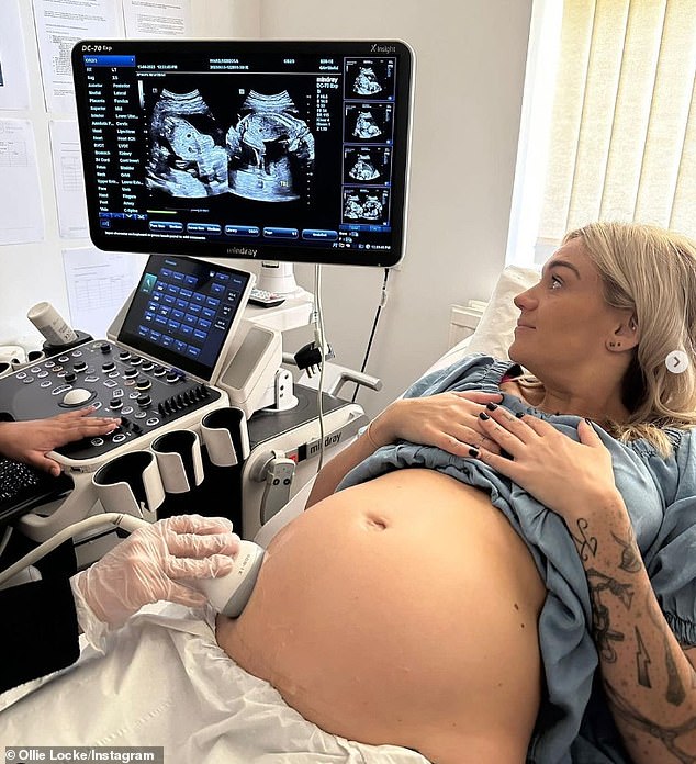 Захватывающие времена: Олли поделился трогательным снимком Ребекки, когда она прошла сканирование в 20 недель в апреле.