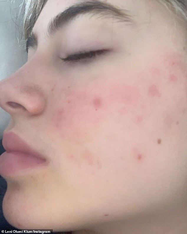 «#nomakeup #nofilter #sowhat», — написала она в хэштегах.