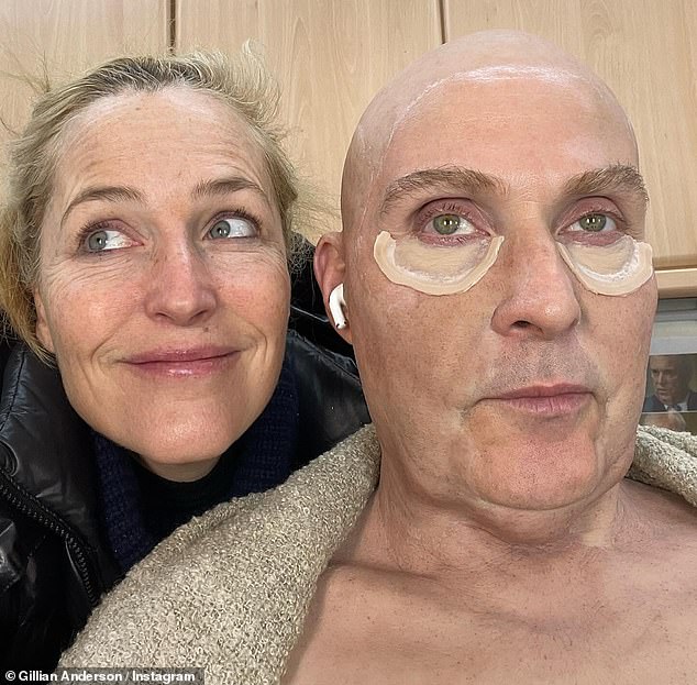 На снимках Джиллиан стоит позади 56-летнего актера, которому на лицо накладывают протез, чтобы он напоминал герцога Йоркского для фильма, в котором задокументирована его печально известная автокатастрофа, интервью BBC.