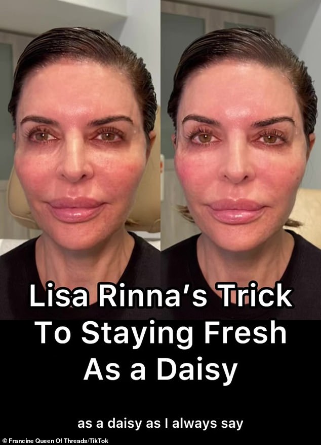 Еще в январе Ринна была показана на TikTok практикующему косметологу Франсин Королева нитей, показывая, как она делает инъекции SkinVive на лицо, а также вид до и после.