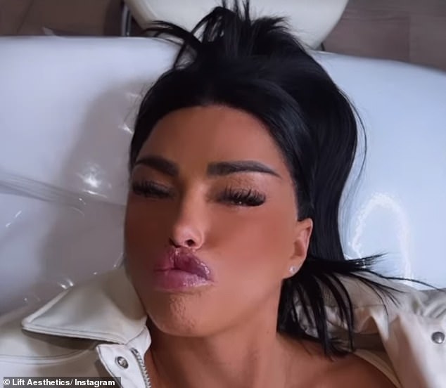 Кэти продемонстрировала свой третий набор наполнителей для губ всего за четыре недели, когда она сморщила свои пухлые губы в видео в Instagram в прошлом месяце.