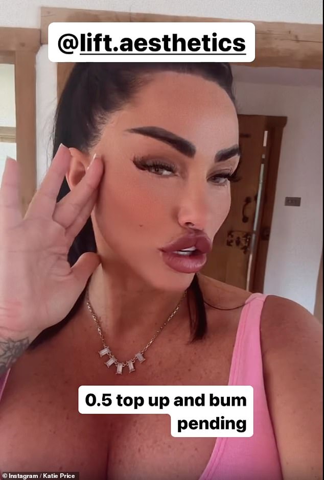 Бывшая 45-летняя модель Glamour после процедуры зашла в Instagram, чтобы выставить напоказ свои пухлые надутые губы в своих историях.