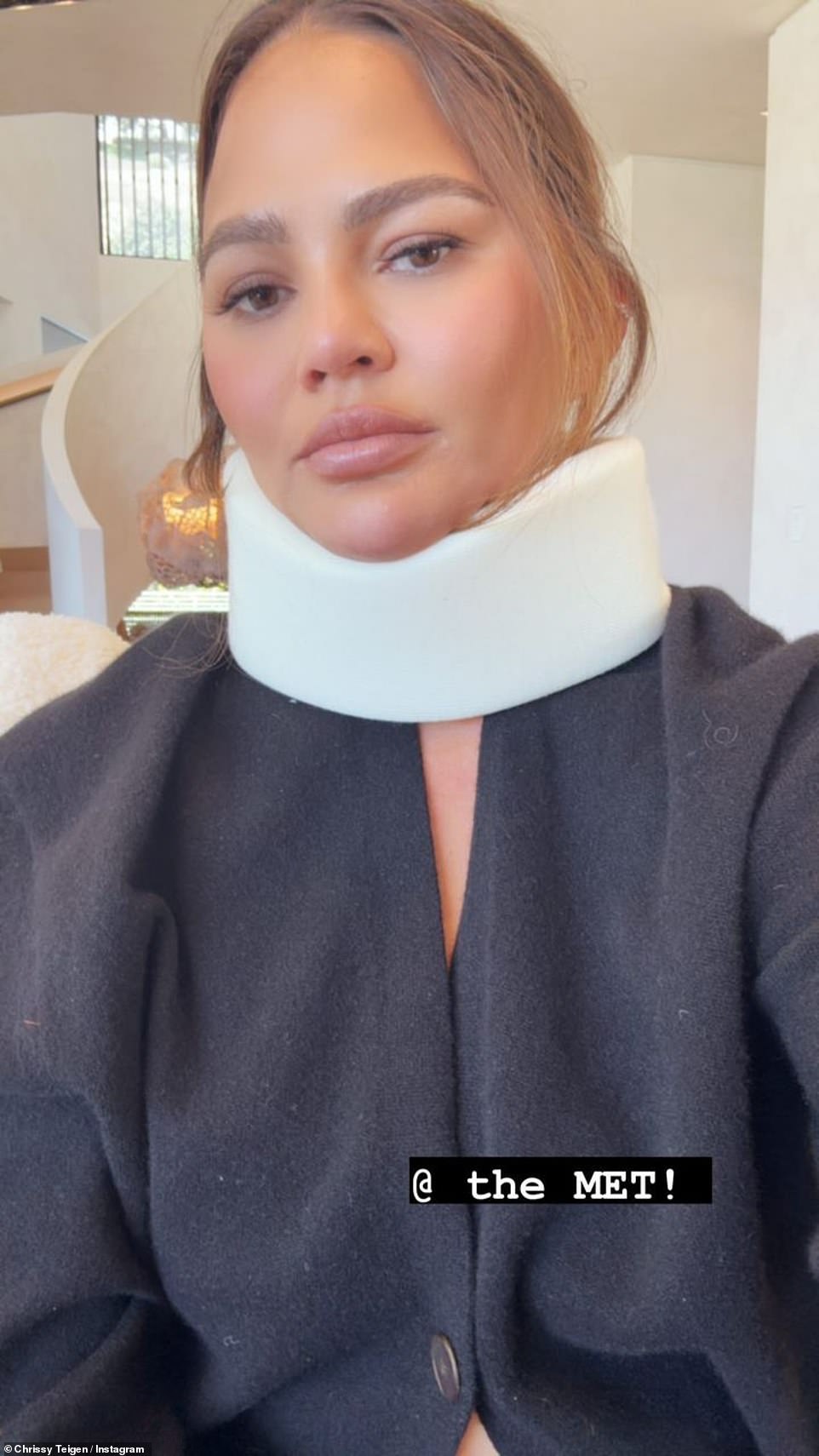 В понедельник Тейген появилась в Instagram с шейным корсетом, подтвердив, что не будет присутствовать на Met Gala 2024 года.  Она рассказала, что получила травму во время попытки встать на голову.