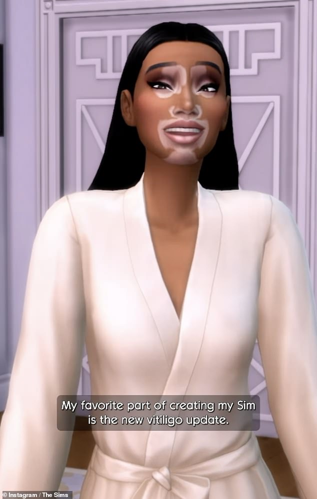 Это произошло после того, как стало известно, что Винни сотрудничает с The Sims 4 над обновлением игры, которое позволяет игрокам создавать персонажей с витилиго.