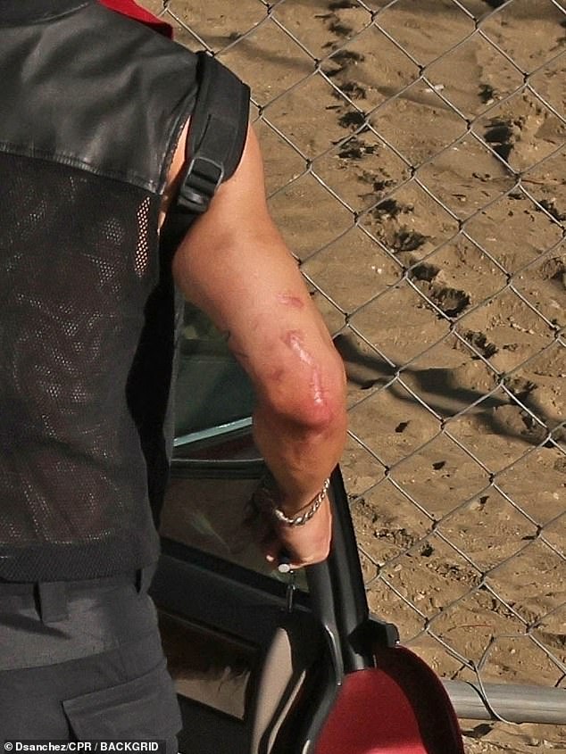 Одетый в жилет из кожи и сетки, Барри был виден шрам, который он получил в результате заражения плотоядными клопами в 2022 году.