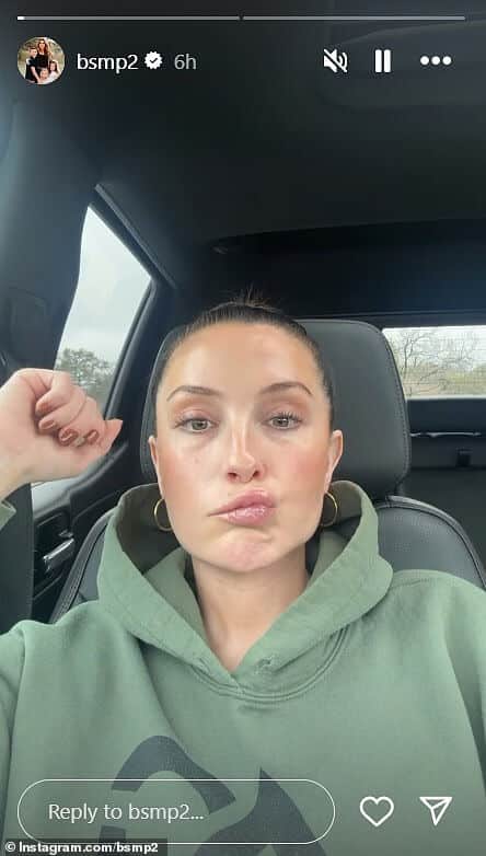 Бристоль Пэйлин рассказала о своем продолжающемся параличе лица в ролике Instagram Stories в среду.